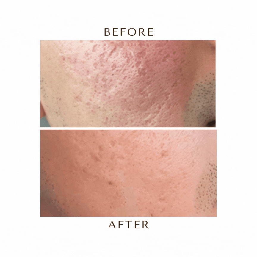 tips for glowing skin (18)