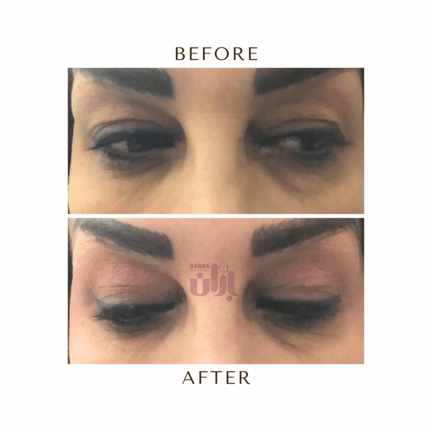 tips for glowing skin (40)