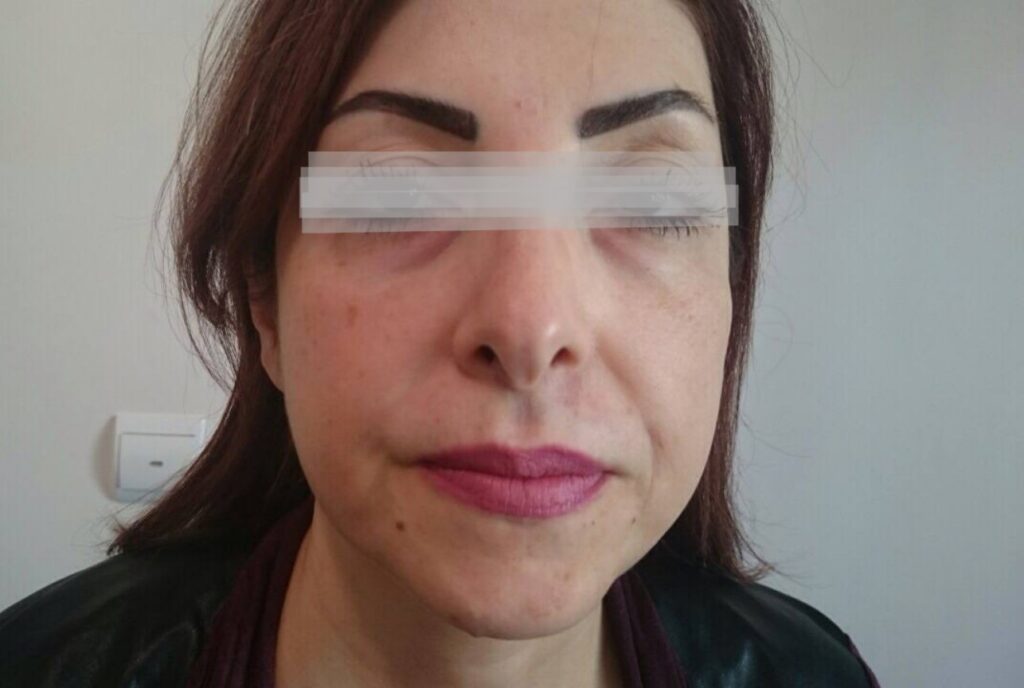 درمان جوانسازی پوست در کلینیک تخصصی باران